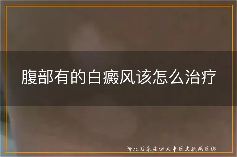 腹部有的白癜风该怎么治疗