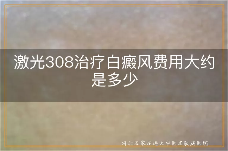 白癜风308激光花费,白斑308治疗价格,白癜风光疗费用多少