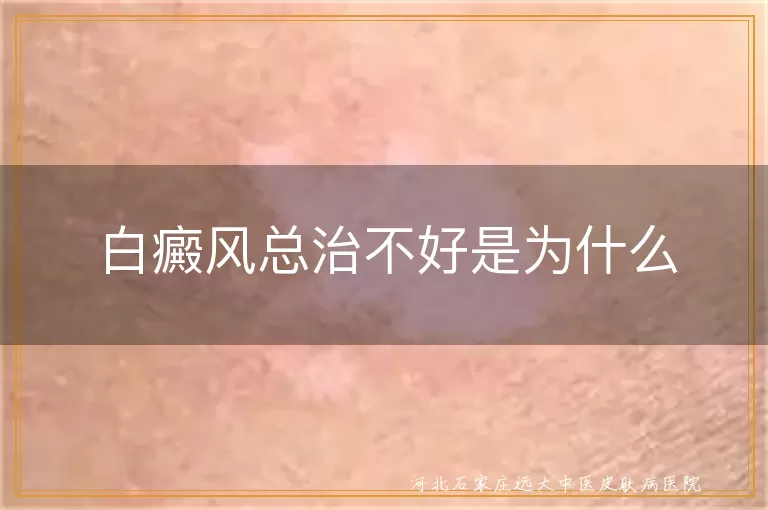 白癜风久治难愈根源在哪,白斑反复治不好原因,白癜风为何迁延难愈