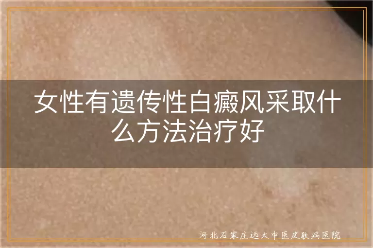 女性遗传性白斑怎么治,女性白癜风遗传干预方案,遗传性白癜风女性治疗策略