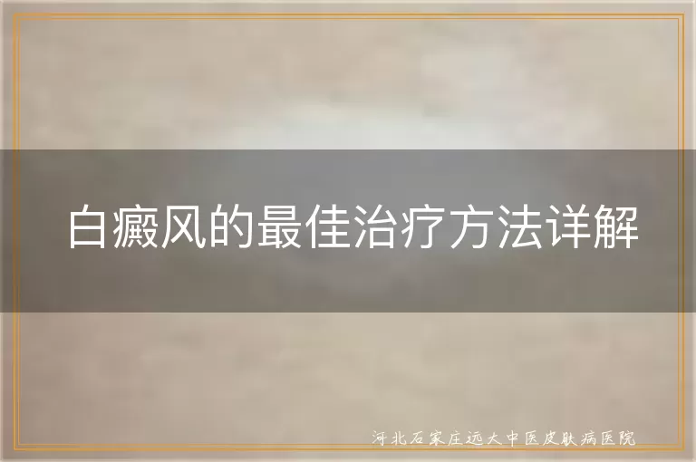 白癜风科学治疗全攻略,白斑个性化康复方案,白癜风系统疗法解析