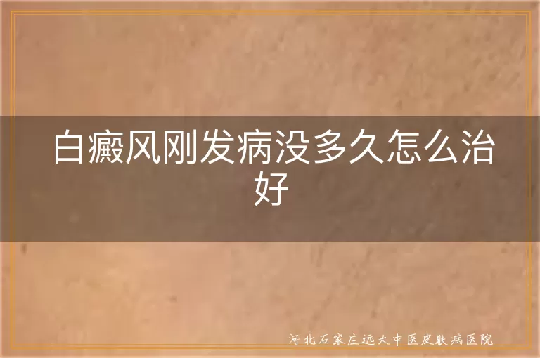 白癜风刚发病没多久怎么治好