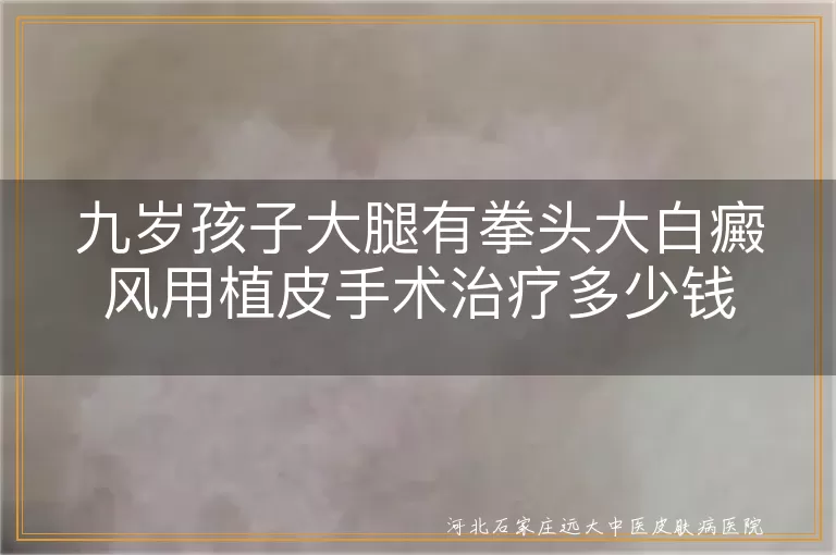 九岁孩子大腿有拳头大白癜风用植皮手术治疗多少钱