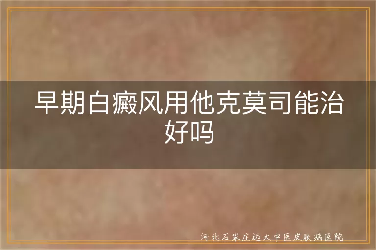 早期白癜风他克莫司治疗效果,白斑初期用药能治好吗,白癜风他克莫司软膏作用