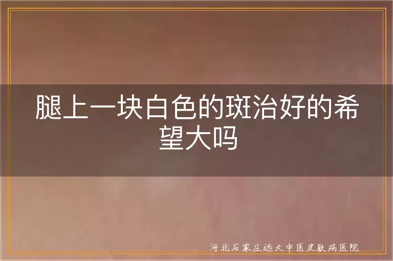 腿部白癜风治疗效果如何,腿上白斑能治好吗,下肢白癜风康复概率