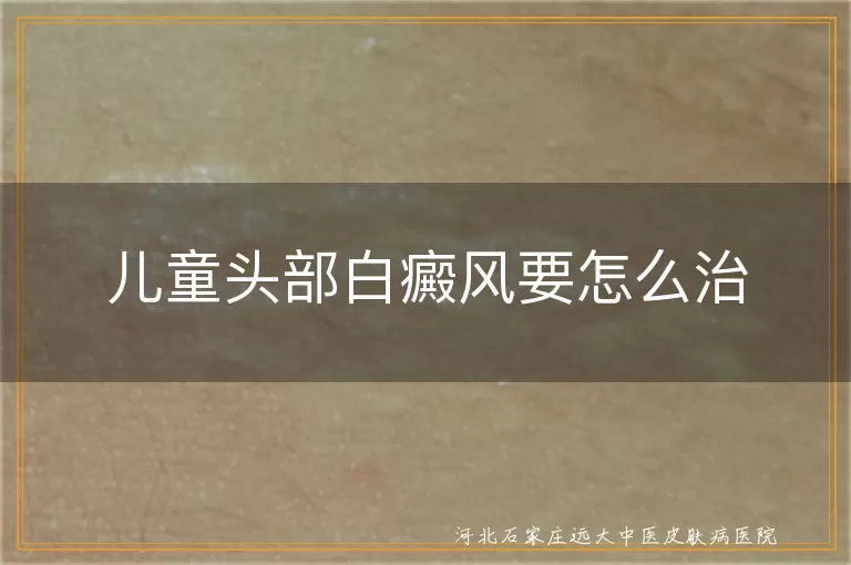 `儿童头部白癜风怎么治疗,小孩头皮白斑如何治疗,儿童发际线白癜风能治好吗`