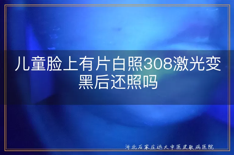 儿童脸上有片白照308激光变黑后还照吗