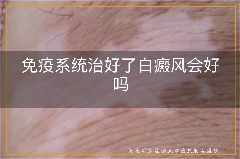 免疫系统治好了白癜风会好吗