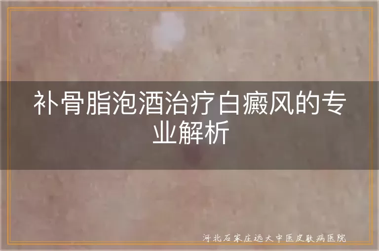 补骨脂泡酒疗法对白癜风的效果分析,补骨脂泡酒治疗白斑的医学原理探讨,白癜风患者使用补骨脂泡酒的注意事项