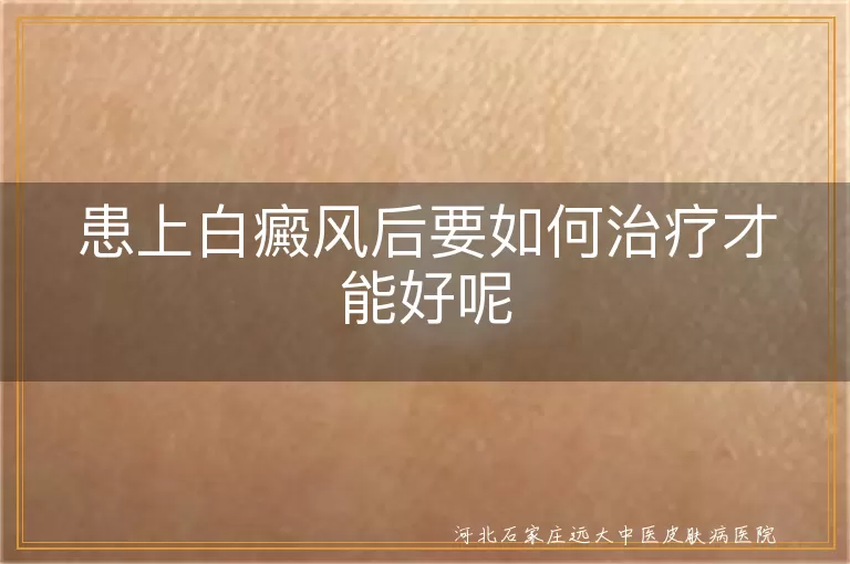 `白癜风科学治疗方法有哪些,白斑患者如何规范诊治,患上白癜风后怎么正确治疗`