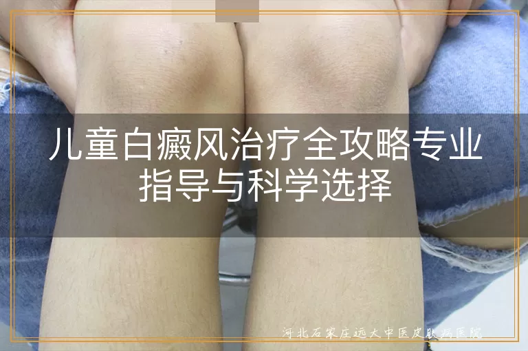 `儿童白癜风早期识别与科学干预方法,小儿白斑病症综合治疗策略探讨,青少年白癜风精准诊疗方案解析`