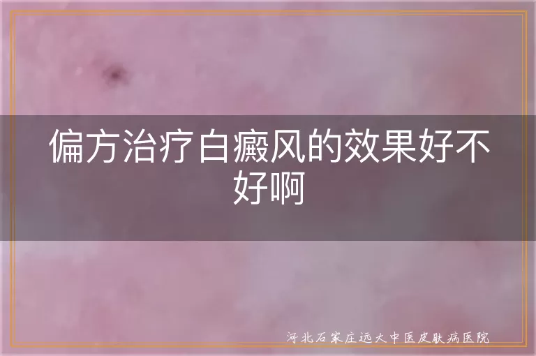 `白癜风偏方治疗真的有效吗,白斑患者使用偏方有哪些风险,治疗白癜风应该相信偏方吗`