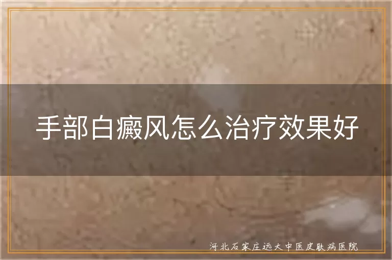 手部白癜风怎么治疗效果好