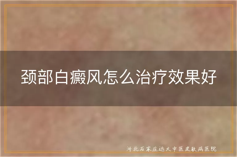 颈部得了白癜风应该怎么治疗好,脖子出现白斑要怎么治疗有效,颈部长了白癜风用什么方法治