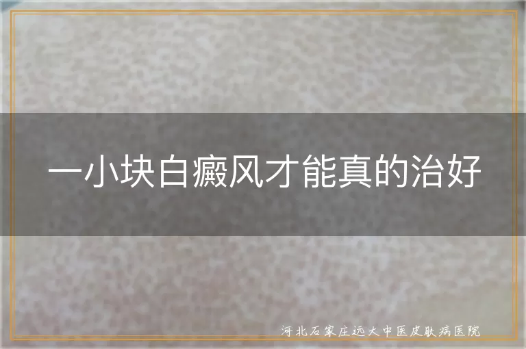 小面积白癜风早期治疗能彻底康复,早期小块白斑及时治疗可根治,白癜风面积越小治愈几率越高