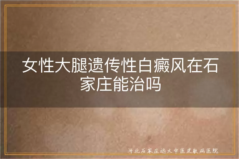女性大腿遗传性白癜风能治吗,石家庄白癜风治疗方法有哪些,腿部白斑治疗去哪里看好