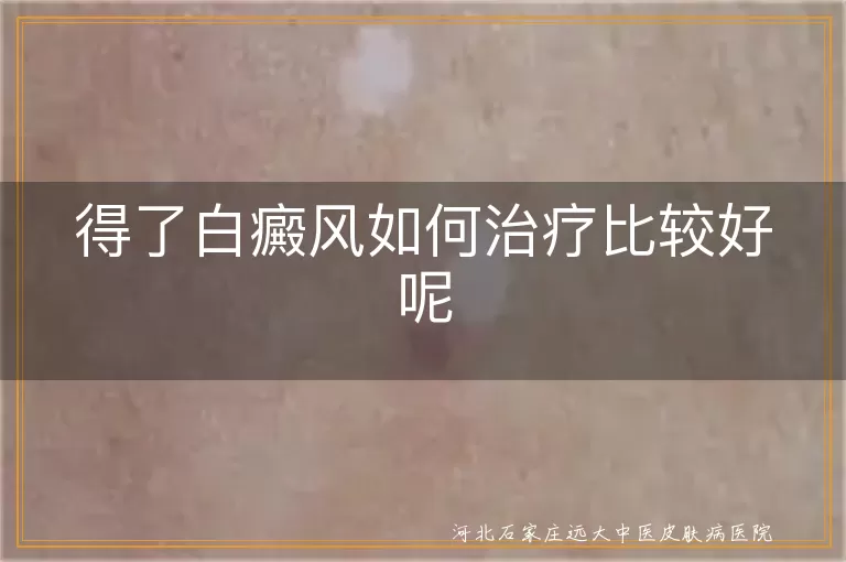 得了白癜风如何治疗比较好呢