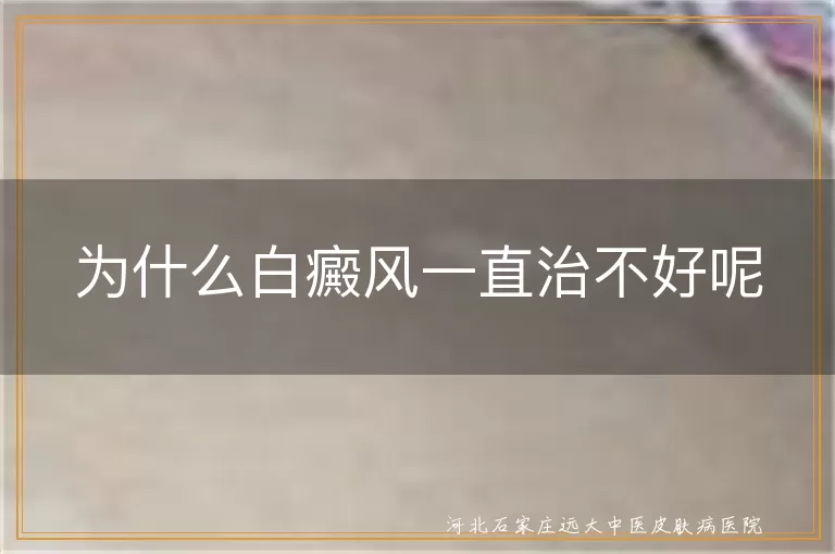 白癜风久治不好是什么原因导致的,皮肤白斑为什么一直治不好呢,白癜风反反复复治不好怎么办