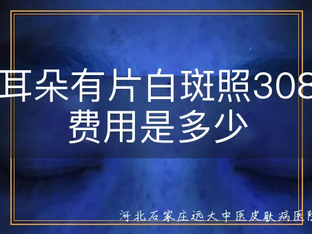 孕妇耳朵白斑照308激光费用,孕期耳部白癜风308治疗价格,孕妇白斑照激光一次多少钱