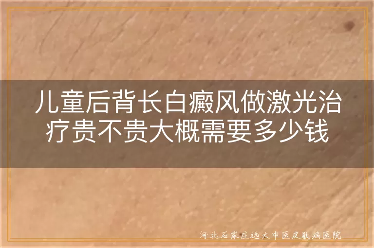 儿童后背长白癜风做激光治疗贵不贵大概需要多少钱