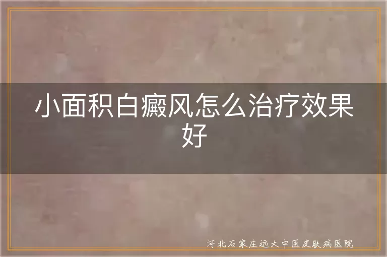 小面积白癜风怎么治疗效果好