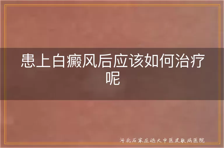 患上白癜风后应该如何治疗呢, 皮肤出现白斑该怎么治疗好, 得了白癜风应该怎么治疗呢