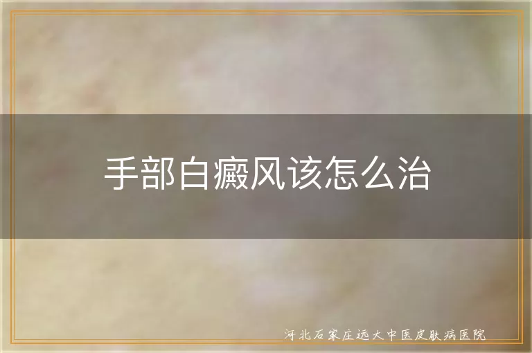 手部白癜风该怎么治
