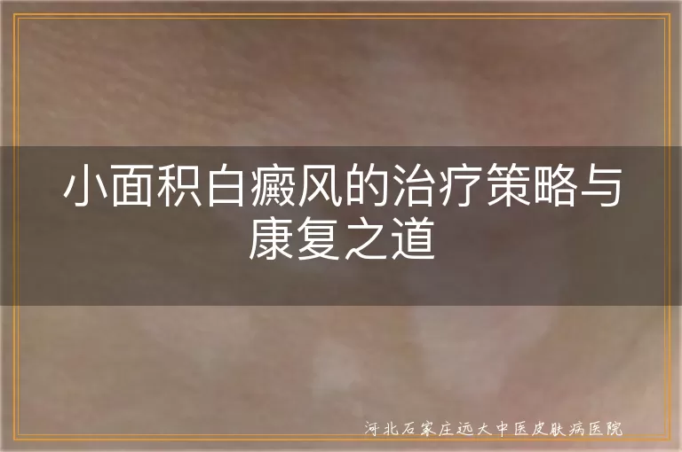 小面积白癜风早期治疗方法,白癜风初期怎么治疗效果好,局限型白斑日常康复护理