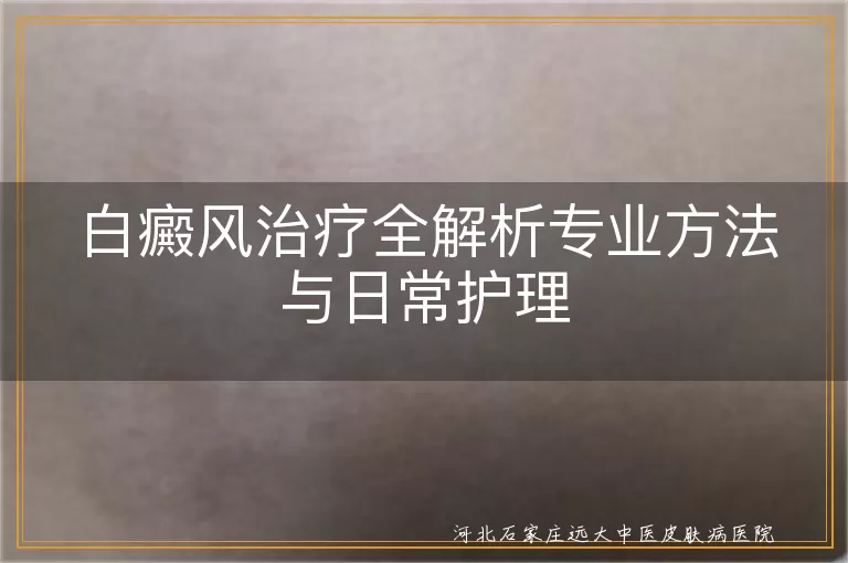 白癜风治疗方法与护理要点,白斑专业治疗方案与护理,白癜风治疗与日常护理全解析