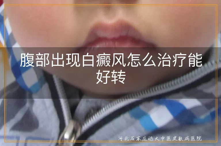 腹部白癜风怎么治疗效果好,肚子上长白斑怎么治能好,腹部出现白癜风该怎么办