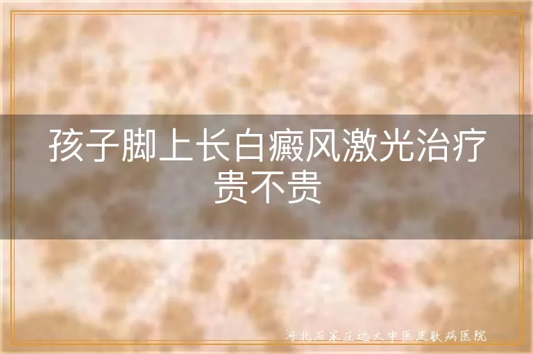 儿童脚部白癜风激光治疗费用高吗,孩子脚上白斑激光治疗多少钱,儿童脚白癜风激光治疗大概价格