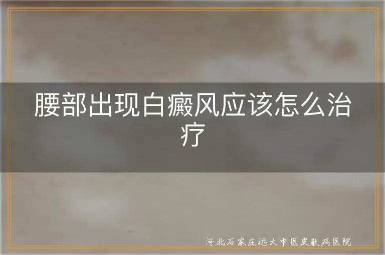 腰部出现白癜风应该怎么治疗