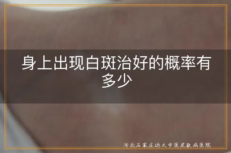 身上白斑治好的概率有多少,白癜风治好的概率大概多少,皮肤白斑能治好吗几率多大