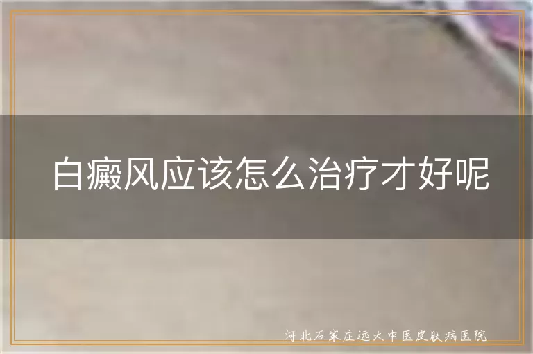 白癜风应该怎么治疗才好呢,白癜风治疗方法有哪些啊,白斑应该怎么治疗才有效
