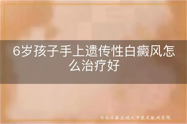 儿童手部遗传性白癜风治疗方法,六岁小孩手上有白斑如何应对,孩子手上遗传性白斑能恢复吗