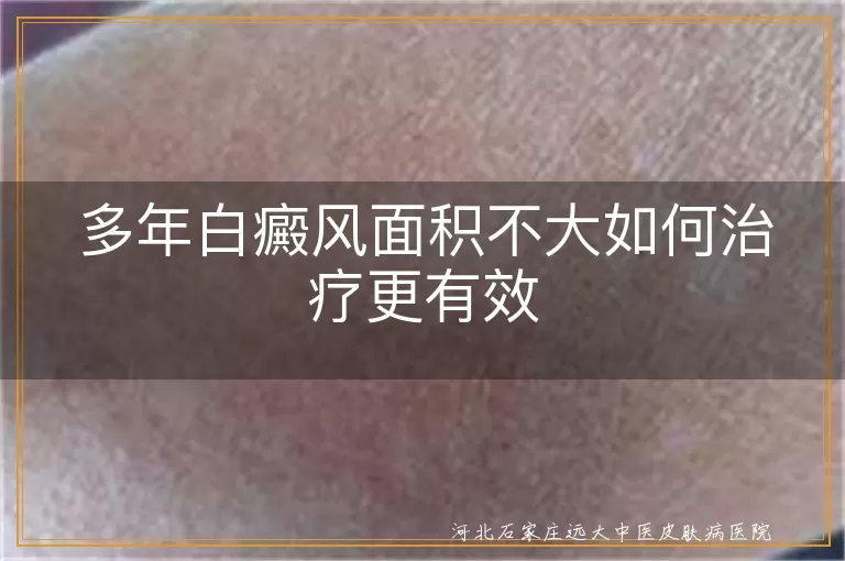 多年小面积白癜风如何有效治疗,白斑多年面积不大怎么治更好,小面积顽固白癜风治疗更有效方法