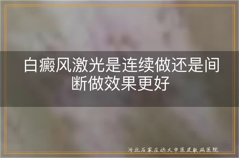 白癜风激光连续还是间断,白斑激光治疗间隔时间,白癜风照激光隔几天一次
