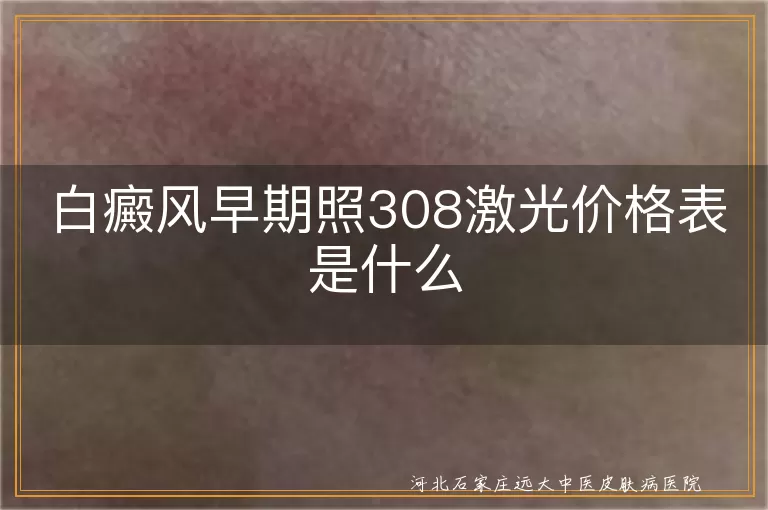 白癜风早期308激光价格表,白斑初期308光疗费用,早期白癜风308收费标准