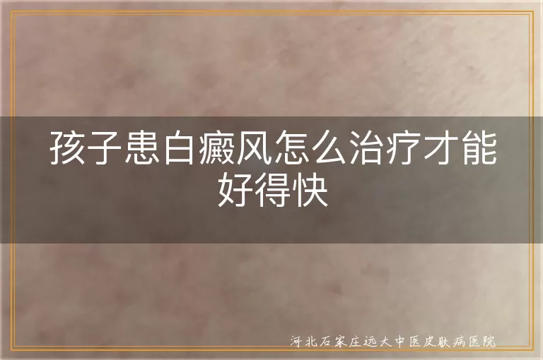 儿童白癜风怎样治疗才能快些好,孩子身上白斑如何治疗效果好,青少年白癜风怎样治疗恢复更快