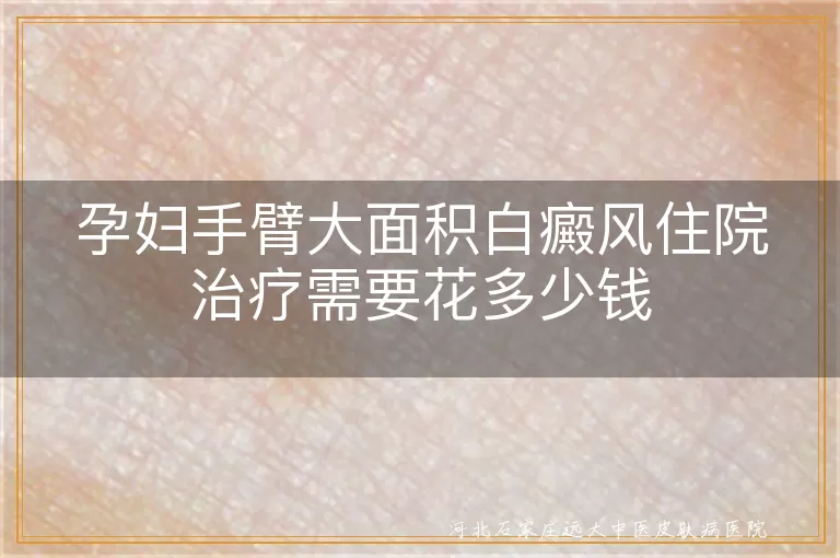 孕妇手臂白斑住院花费查询,手臂大面积白癜风住院费用,孕妇患白癜风住院要花多少钱