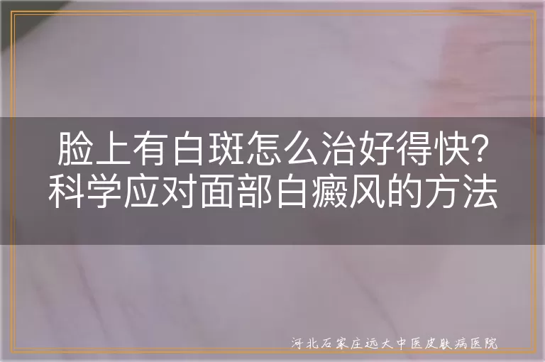 脸上白癜风怎么治疗才有效,面部白斑治疗正确方法分享,脸上有白癜风该如何尽快处理
