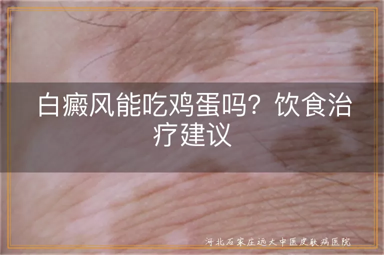 白癜风患者日常饮食鸡蛋能否食用,白斑皮肤能吃鸡蛋吗饮食治疗建议,白癜风食谱中鸡蛋可不可以吃