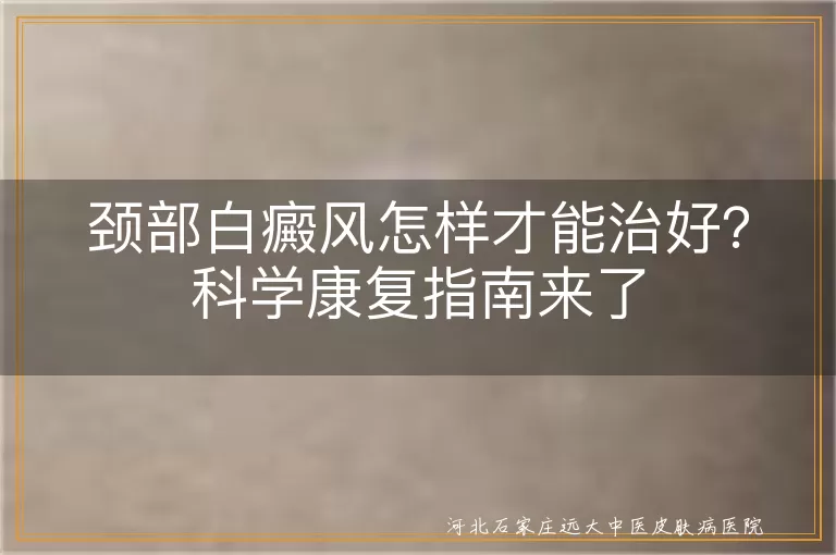颈部白癜风怎么治疗才能恢复,脖子白斑如何治好不复色,颈部白癜风康复有效方法有哪些