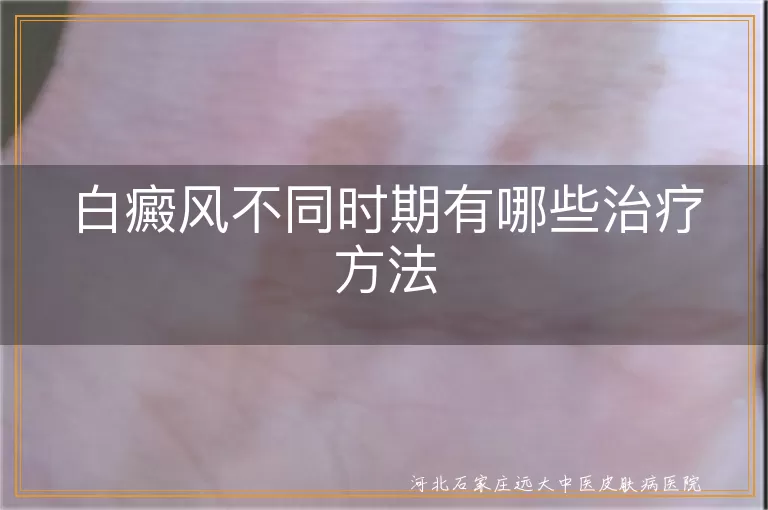 白斑初期与后期治疗方式,白癜风各个阶段怎么应对,不同时期白癜风处理办法