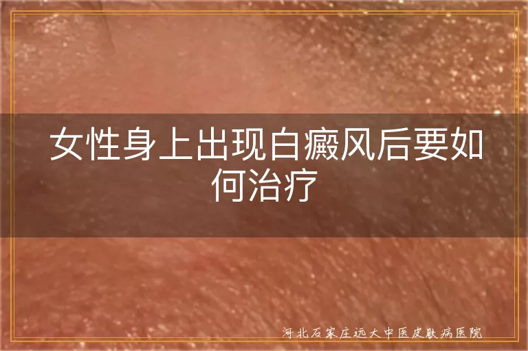 女性白癜风怎么治疗效果好,女性身上白斑如何治疗恢复,女性白癜风治疗与护理方法