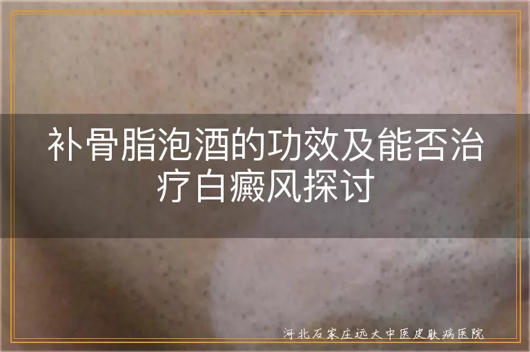补骨脂泡酒治白癜风有效吗,白斑涂抹补骨脂酒靠谱吗,补骨脂泡酒对白斑的功效如何