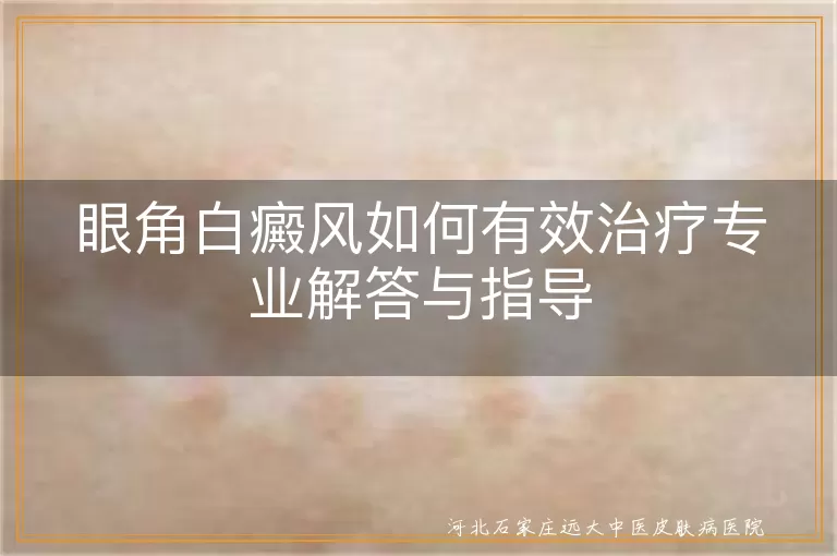 眼角白癜风如何有效治疗专业解答与指导