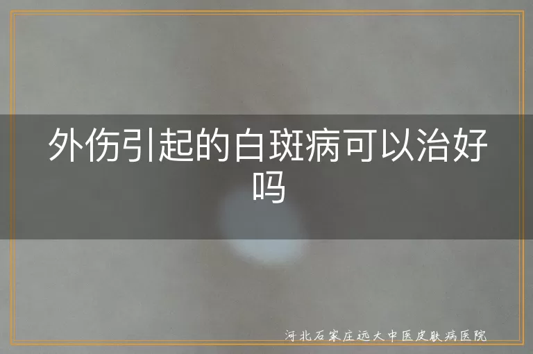 外伤引发的白斑是白癜风能治好吗,外伤性白斑如何恢复白癜风须知,皮肤受伤后白斑病能不能治好