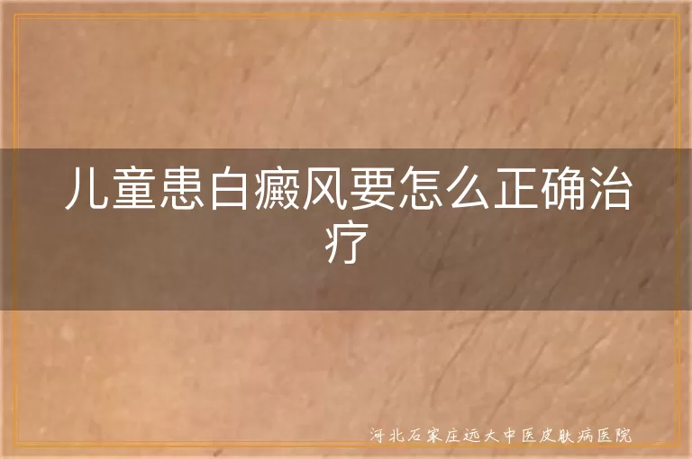 儿童得了白癜风该怎么治疗好,小孩身上长白斑如何治疗,儿童白癜风正确治疗方法有哪些