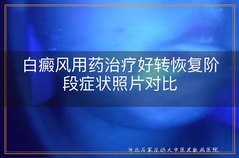 白斑用药好转恢复期症状照片,白癜风有效恢复阶段皮肤图,白斑好转阶段症状对照图片